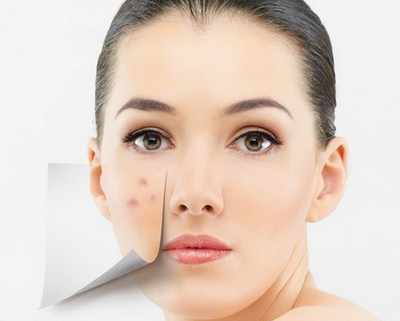 內(nèi)分泌失調(diào)臉上長(zhǎng)痘痘怎么辦