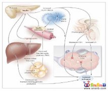 多囊卵巢綜合癥（PCOS）診斷中提及到的肥胖