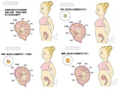 懷孕3個月胎兒發(fā)育過程圖